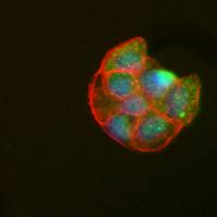 3 - Recombinant Anti-Syntenin Rabbit mAb AP95294