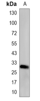 1 - Recombinant Anti-Syntenin Rabbit mAb AP95294