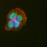 3 - Recombinant Anti-CUGBP1 Rabbit mAb AP95295