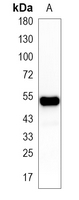 1 - Recombinant Anti-CUGBP1 Rabbit mAb AP95295