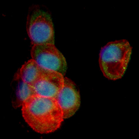3 - Recombinant Anti-IMPDH2 Rabbit mAb AP95296