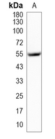 1 - Recombinant Anti-IMPDH2 Rabbit mAb AP95296