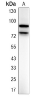 1 - Recombinant Anti-MARK2 Rabbit mAb AP95298