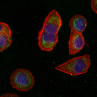 3 - Recombinant Anti-KLC3 Rabbit mAb AP95299