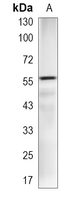 1 - Recombinant Anti-KLC3 Rabbit mAb AP95299
