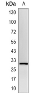 1 - Recombinant Anti-PITX3 Rabbit mAb AP95300