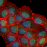 3 - Recombinant Anti-AIOLOS Rabbit mAb AP95302
