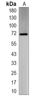 1 - Recombinant Anti-AIOLOS Rabbit mAb AP95302