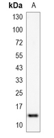 1 - Recombinant Anti-EG-VEGF Rabbit mAb AP95303