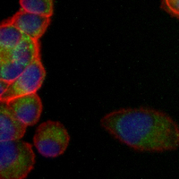 3 - Recombinant Anti-Thyroglobulin Rabbit mAb AP95304