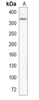 1 - Recombinant Anti-Thyroglobulin Rabbit mAb AP95304