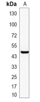 1 - Recombinant Anti-PEDF Rabbit mAb AP95305