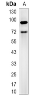 1 - Recombinant Anti-TCF4 Rabbit mAb AP95306