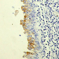 19 - Recombinant Anti-Uroplakin 3a Rabbit mAb AP95308