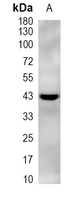 1 - Recombinant Anti-Uroplakin 3a Rabbit mAb AP95308