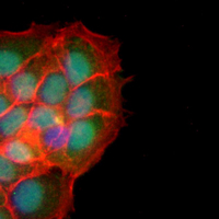 3 - Recombinant Anti-TCL-1A Rabbit mAb AP95309