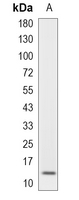 1 - Recombinant Anti-TCL-1A Rabbit mAb AP95309