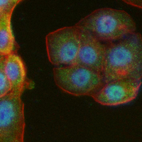 3 - Recombinant Anti-LIN28A Rabbit mAb AP95310