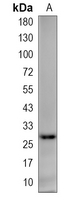 1 - Recombinant Anti-LIN28A Rabbit mAb AP95310