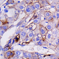 19 - Recombinant Anti-GCTM-2 Rabbit mAb AP95313