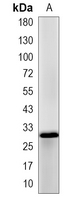 1 - Recombinant Anti-EIF4E Rabbit mAb AP95315