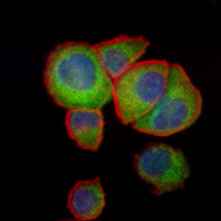 3 - Recombinant Anti-CLASP1 Rabbit mAb AP95316