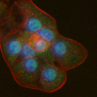 3 - Recombinant Anti-BCL2L15  Rabbit mAb AP95318