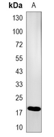 1 - Recombinant Anti-BCL2L15  Rabbit mAb AP95318