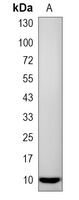 1 - Recombinant Anti-Trefoil Factor 3 Rabbit mAb AP95319