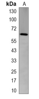 1 - Recombinant Anti-Synoviolin Rabbit mAb AP95320
