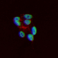 3 - Recombinant Anti-Histone H3 (Acetyl-K18) Rabbit mAb AP95321