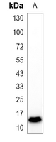 1 - Recombinant Anti-Histone H3 (Acetyl-K18) Rabbit mAb AP95321