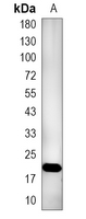 1 - Recombinant Anti-SRSF3 Rabbit mAb AP95323