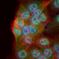 3 - Recombinant Anti-RAIDD Rabbit mAb AP95324
