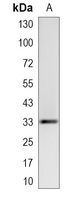 1 - Recombinant Anti-NDUFAF1 Rabbit mAb AP95325