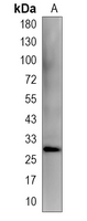 1 - Recombinant Anti-Calpain Rabbit mAb AP95328