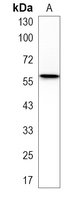 1 - Recombinant Anti-HSF2 Rabbit mAb AP95329