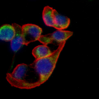 3 - Recombinant Anti-Cripto 1 Rabbit mAb AP95330