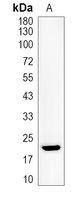 1 - Recombinant Anti-Cripto 1 Rabbit mAb AP95330