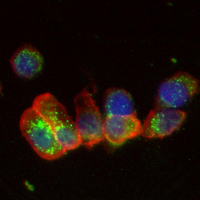 3 - Recombinant Anti-DFF45 Rabbit mAb AP95331