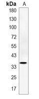1 - Recombinant Anti-DFF45 Rabbit mAb AP95331