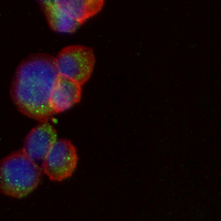 3 - Recombinant Anti-Desmoplakin Rabbit mAb AP95334