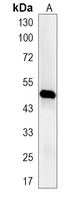 1 - Recombinant Anti-BMP15 Rabbit mAb AP95335