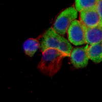 3 - Recombinant Anti-LTA4H Rabbit mAb AP95337
