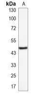 1 - Recombinant Anti-WNT5B Rabbit mAb AP95341