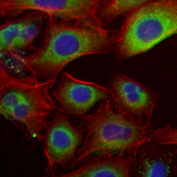 3 - Recombinant Anti-EPHB3 Rabbit mAb AP95348