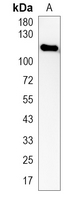 1 - Recombinant Anti-EPHB3 Rabbit mAb AP95348