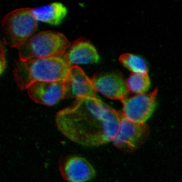 3 - Recombinant Anti-VEGFD Rabbit mAb AP95349
