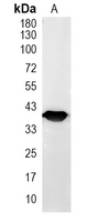 1 - Recombinant Anti-VEGFD Rabbit mAb AP95349