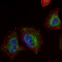 3 - Recombinant Anti-Kallikrein 5 Rabbit mAb AP95353